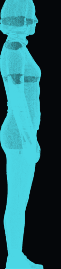 3D body scan, wireframe view